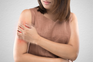 malaria treatment
