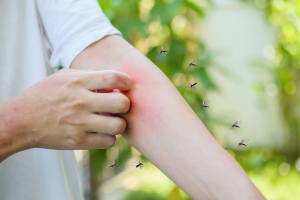 malaria prevention treatment